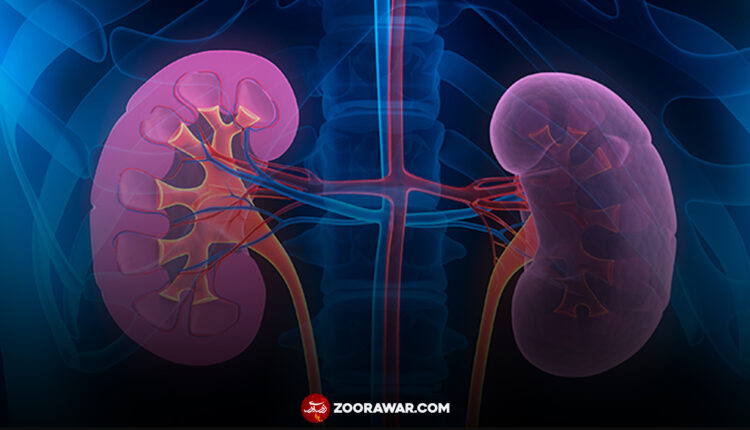 kidney failure causes